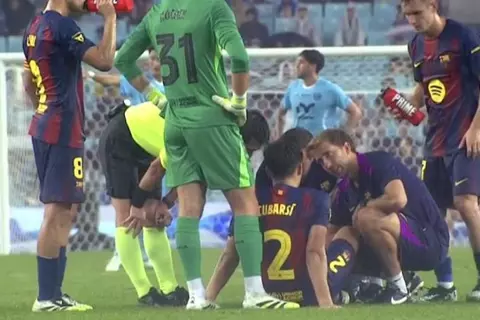 تقرير: كوبارسي يعاني من كدمة في قدمه اليسرى